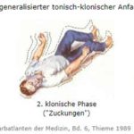 Deutsches Epilepsiemuseum (2)